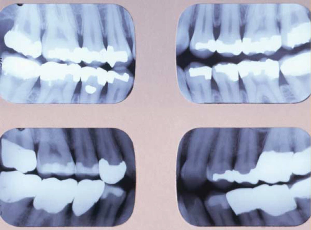 Dental Imaging 2 3 1 e1660199504387