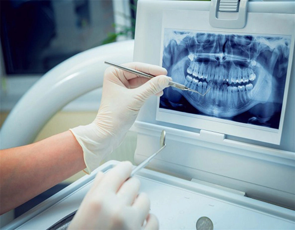 Dental Clinic in Dubai 4 dental imaging