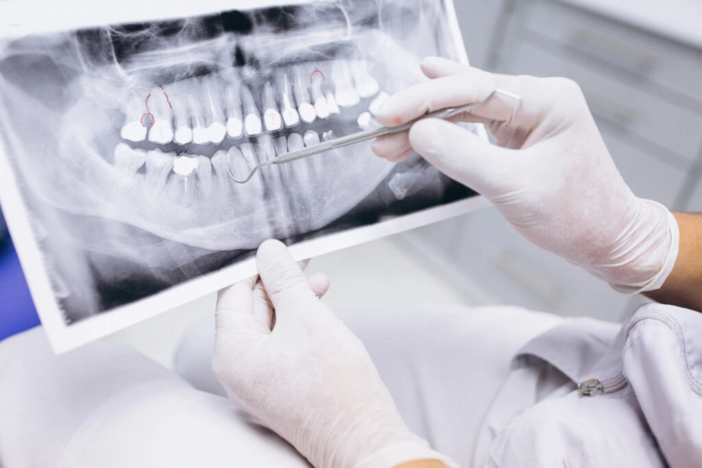 Dental Imaging 3 x ray teeth 1024x683 1