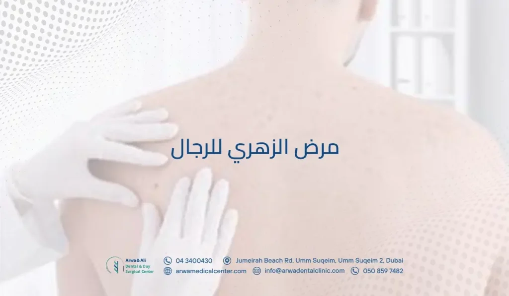 مرض الزهري للرجال