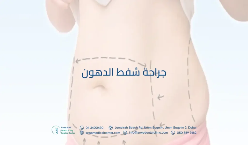 ما هي جراحة شفط الدهون؟ وهل عملية شفط دهون البطن مؤلمة؟ 2 جراحة شفط الدهون