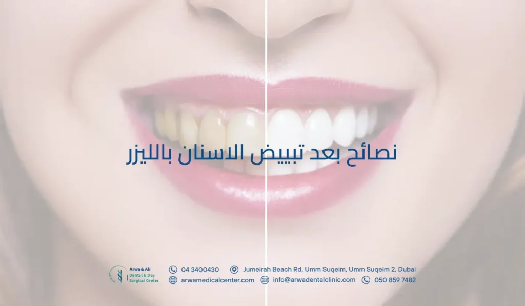 نصائح بعد تبييض الاسنان بالليزر: كم يستمر الآلم بعد التبييض؟ 3 نصائح بعد تبييض الاسنان بالليزر